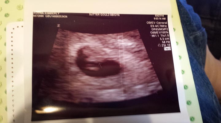 First Ultrasound